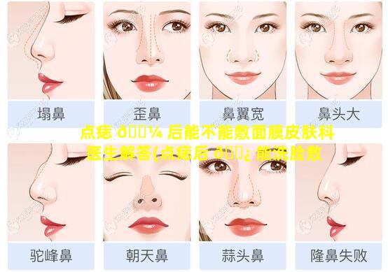 点痣 🌼 后能不能敷面膜皮肤科医生解答(点痣后 🌿 能洗脸敷面膜用护肤品吗)